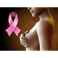 sindromul cancerului ereditar de san si de ovar