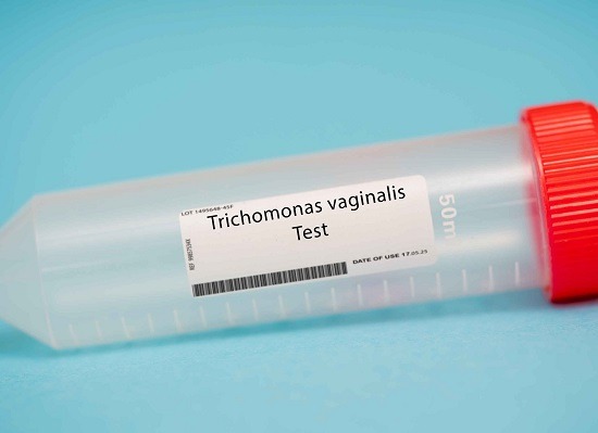 Ce trebuie să ştii despre infecţia cu Trichomonas vaginalis