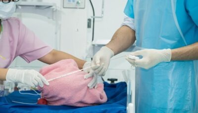 Ce înseamnă scorul Apgar?