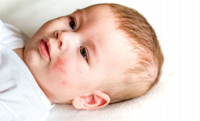 Tot ce trebuie sa stii despre iritatiile pielii la bebelusi