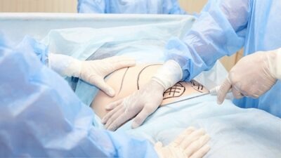 Histerectomie laparoscopică: care sunt beneficiile?