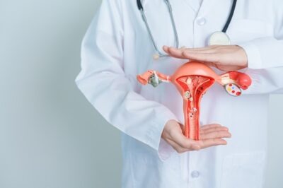 Embolizare fibrom uterin: ce trebuie să știi
