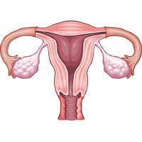 Semnele si simptomele atreziei vaginale