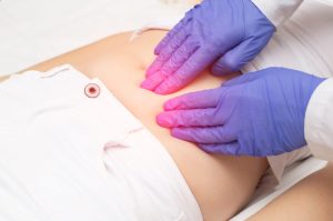 Fibromul uterin este o cauză a avortului spontan