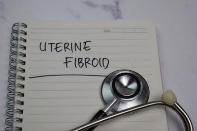 Fibromul uterin este o cauză a avortului spontan