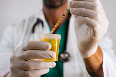 Infecția urinară – diagnostic, simptome și tratament