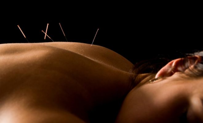 Despre acupunctură și rolul ei în tratarea infertilității