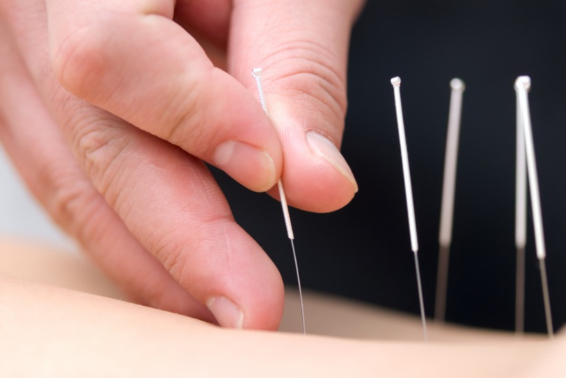 Despre acupunctură rolul în infertilității - for You