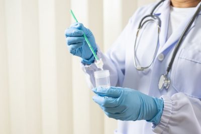 Opțiuni de tratament după un test Papanicolau anormal