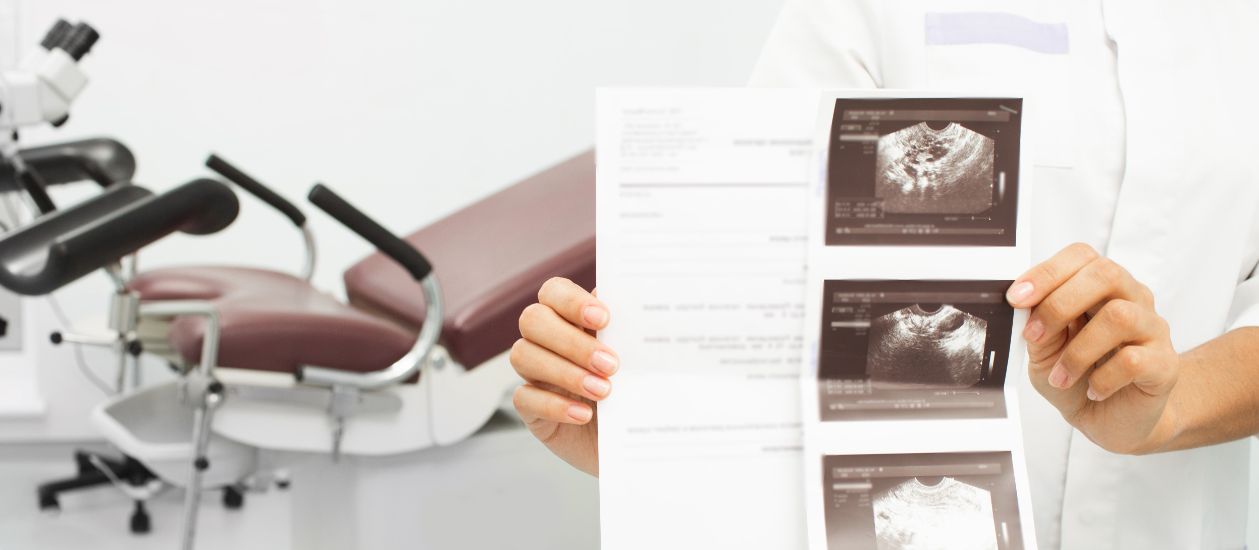 Polip uterin: simptome, tratament