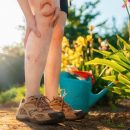 Cum sa preveniti si sa tratati venele sparte pe picioare – sfaturi si remedii eficiente